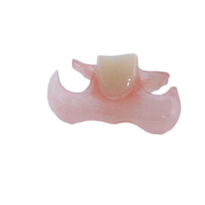 Impress3D Digital Valplast® Partial Dentures for Dentists and Patients